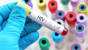 2 more HIV Aids infected children die in Larkana