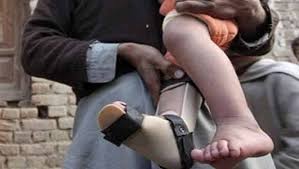 5 more polio cases confirmed in K-P