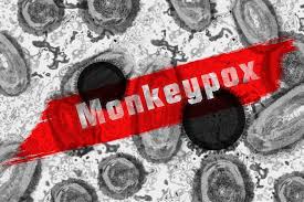 Monkey pox in Pakistan